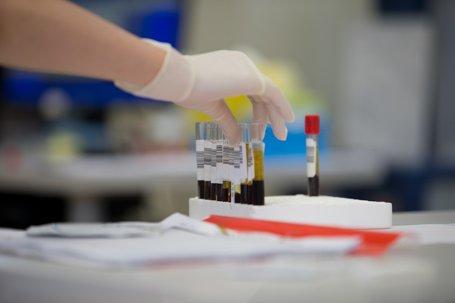 Come prepararsi per la prima donazione di sangue